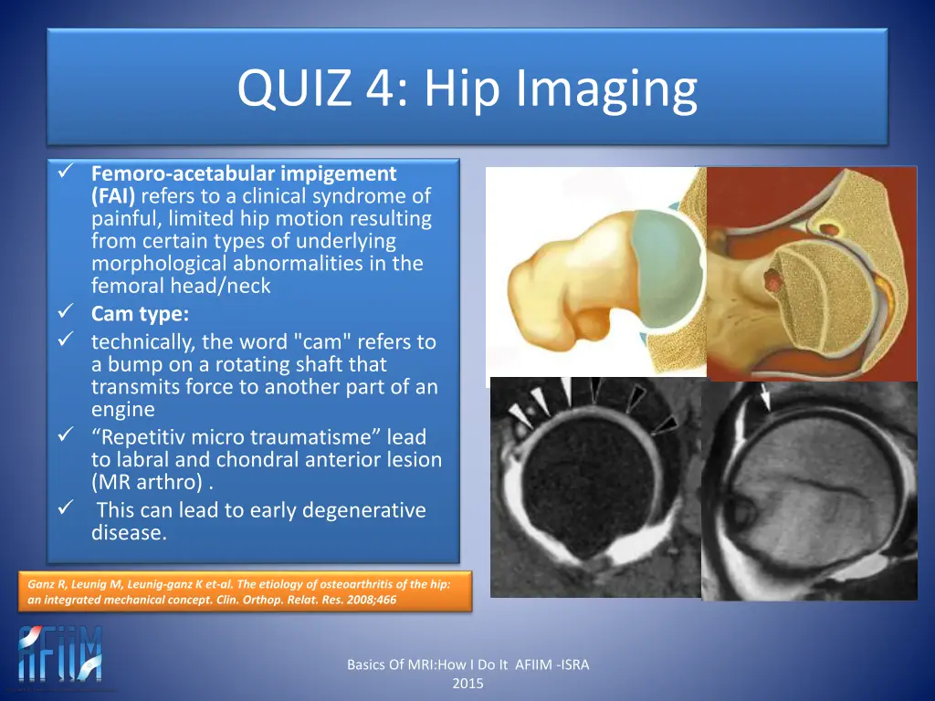 quiz 4 hip imaging 12