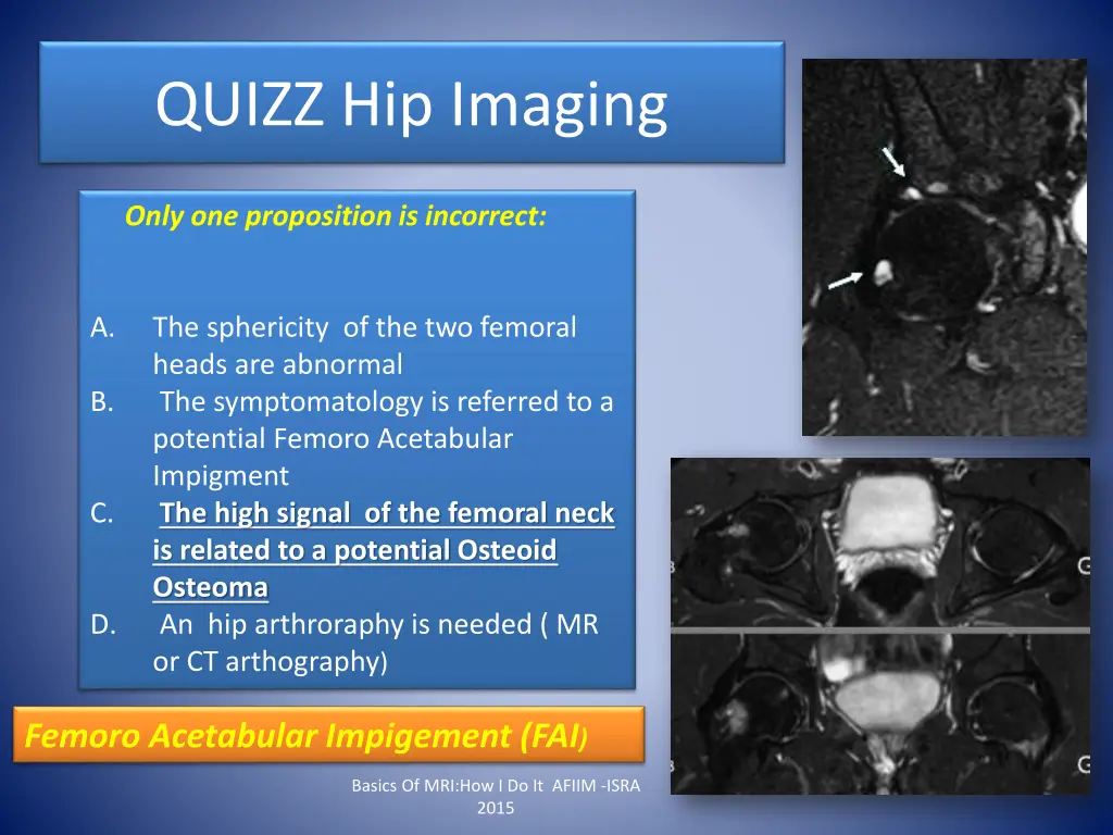 quizz hip imaging 1