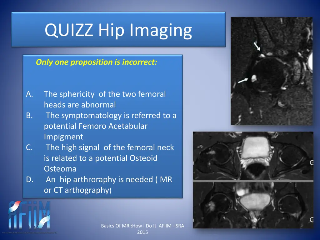 quizz hip imaging