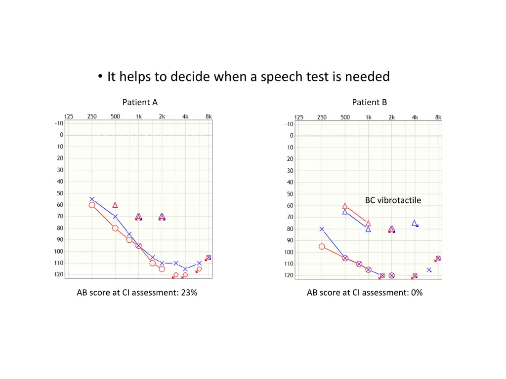 it helps to decide when a speech test is needed