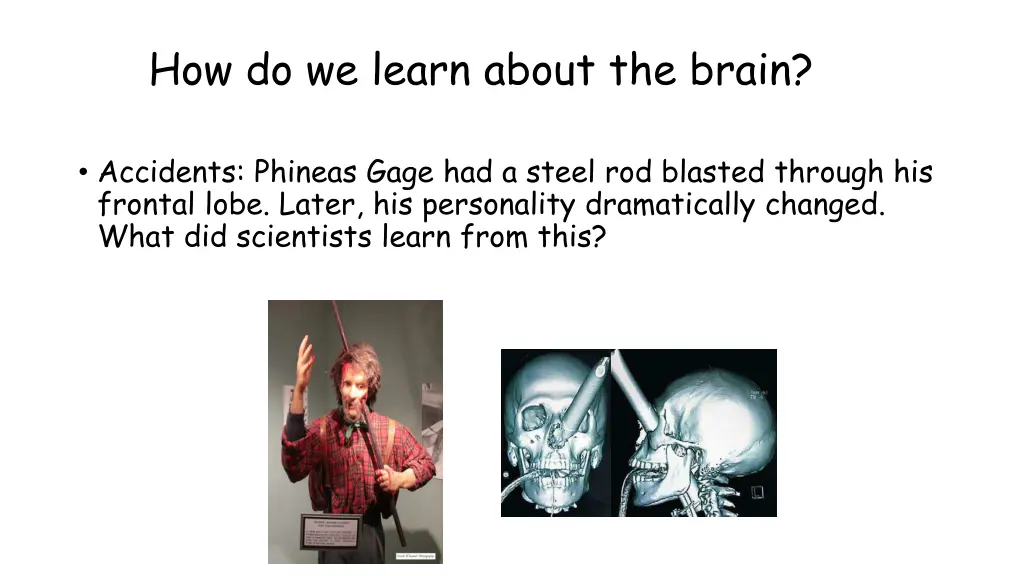 how do we learn about the brain