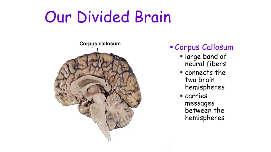 our divided brain