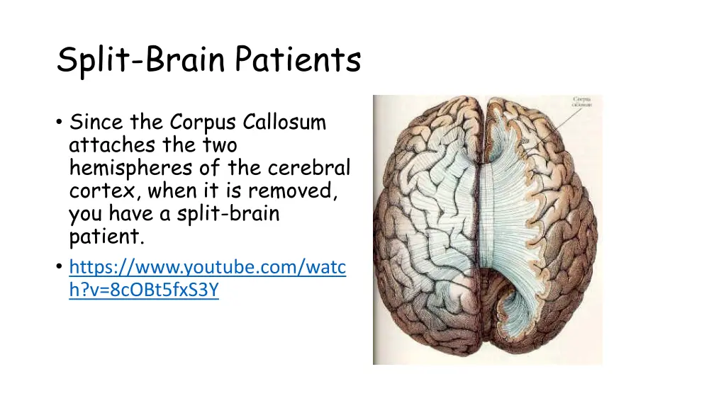 split brain patients