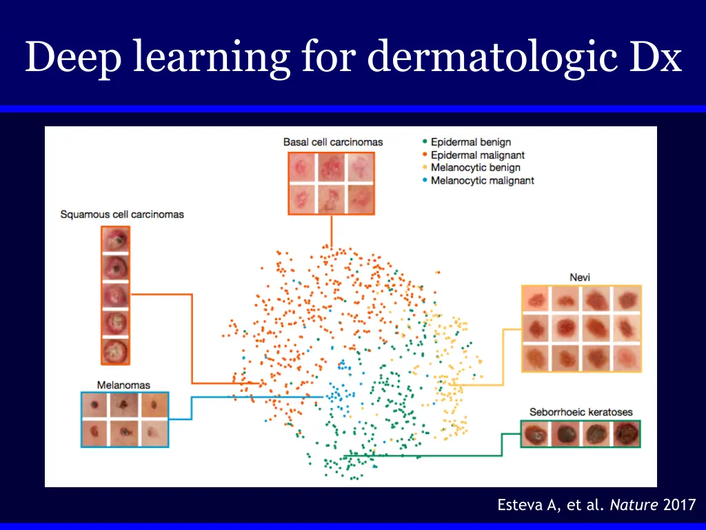 deep learning for dermatologic dx