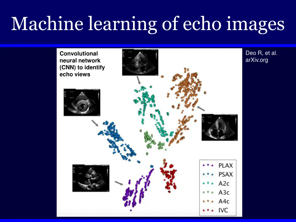 machine learning of echo images 2