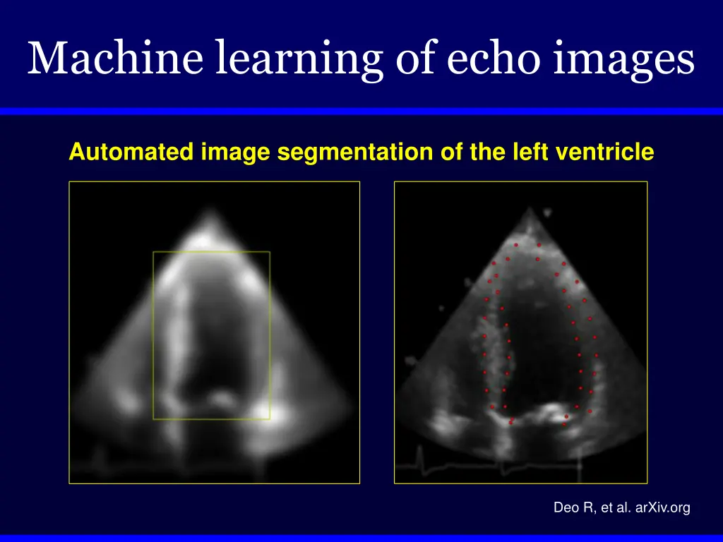 machine learning of echo images 3