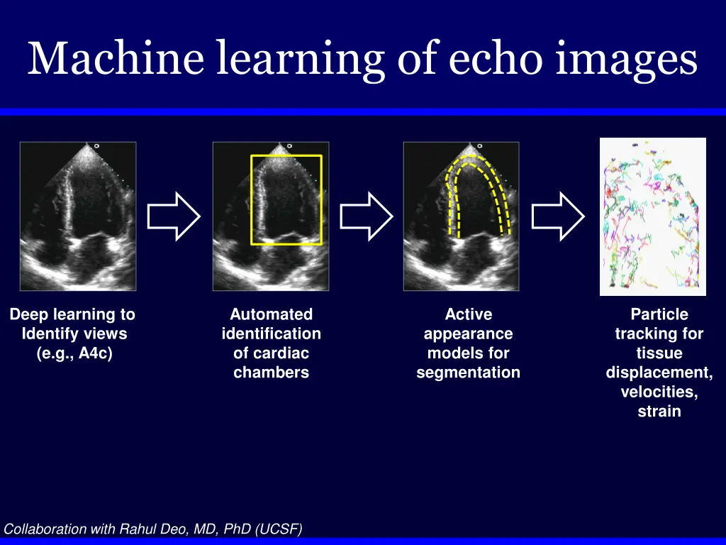 machine learning of echo images