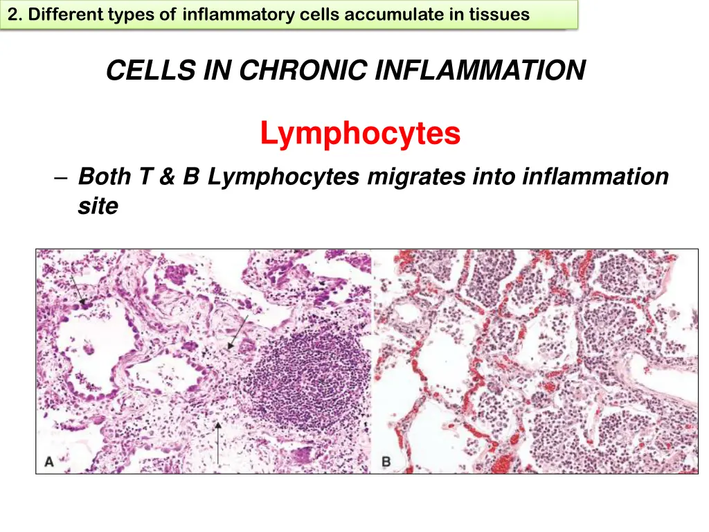 1 define chronic inflammation its causes effects 14