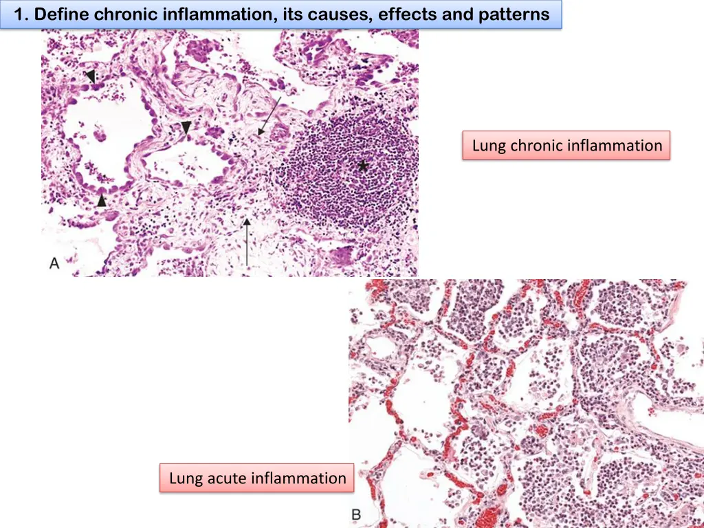 1 define chronic inflammation its causes effects 7