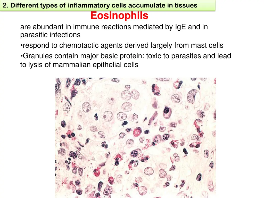 2 different types of inflammatory cells 5