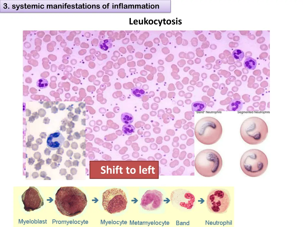 3 systemic manifestations of inflammation 3