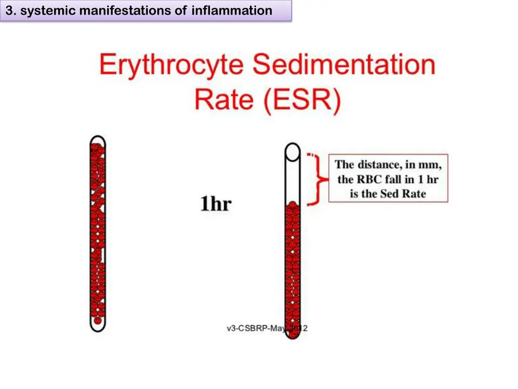 3 systemic manifestations of inflammation 7