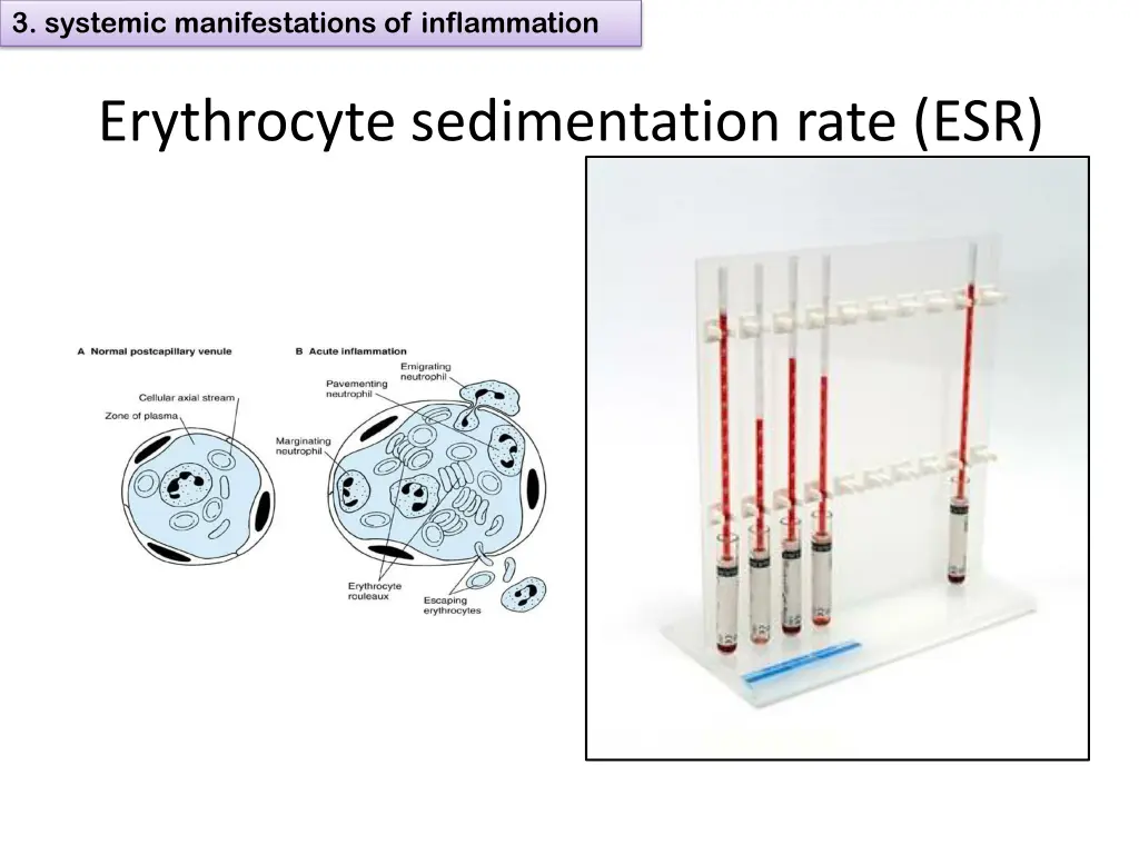 3 systemic manifestations of inflammation 8