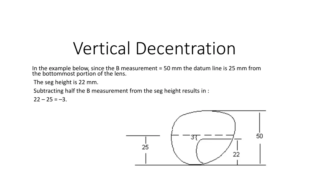 vertical decentration 1