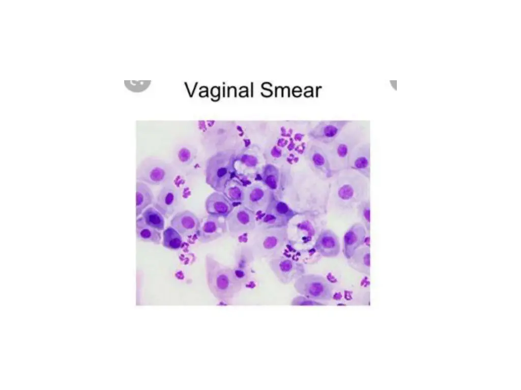 slide25