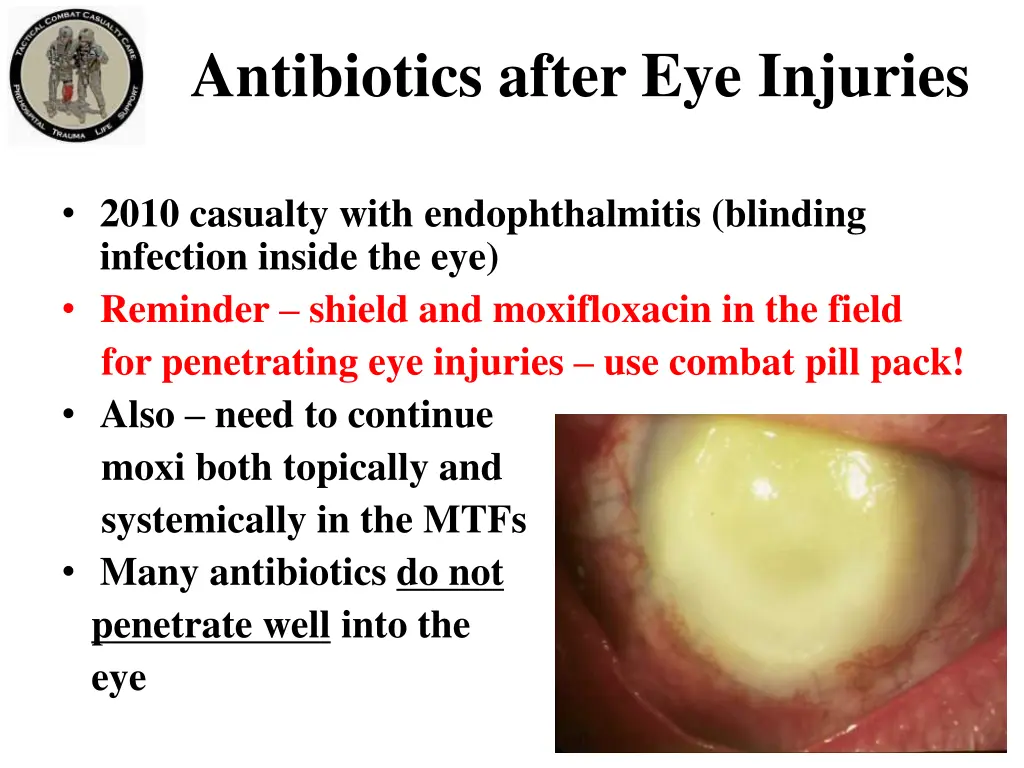 antibiotics after eye injuries 2010 casualty with