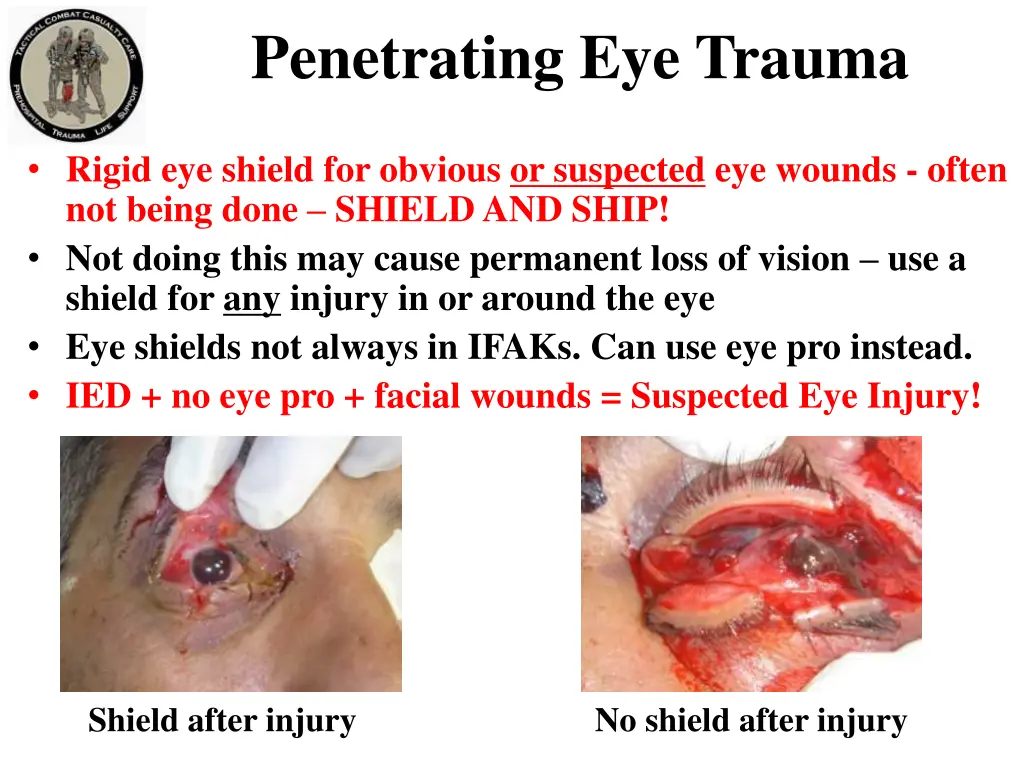 penetrating eye trauma