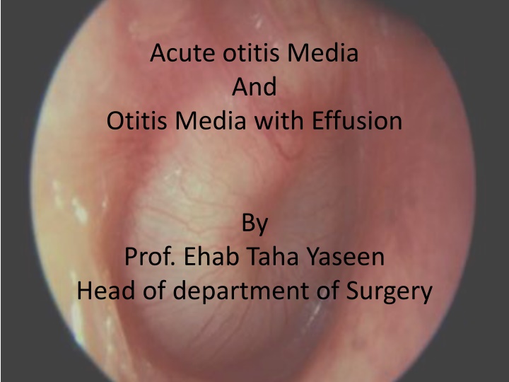 acute otitis media and otitis media with effusion