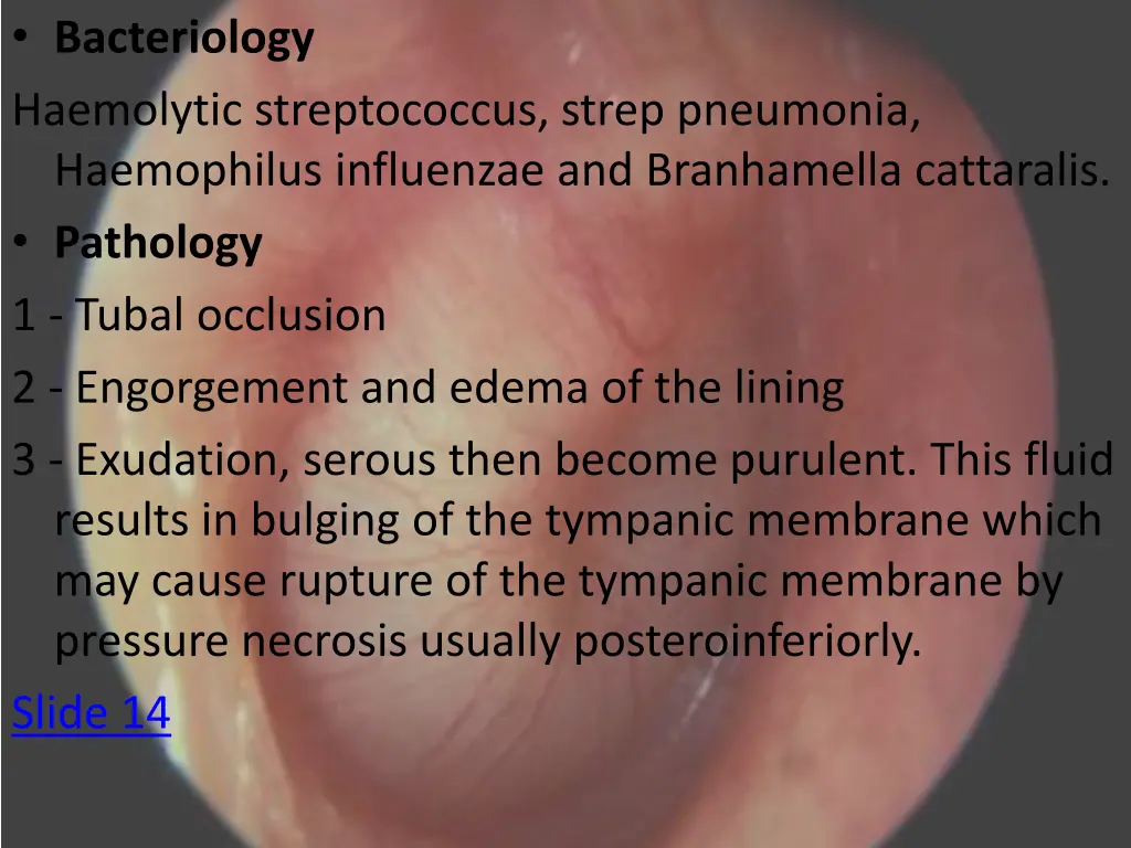 bacteriology haemolytic streptococcus strep