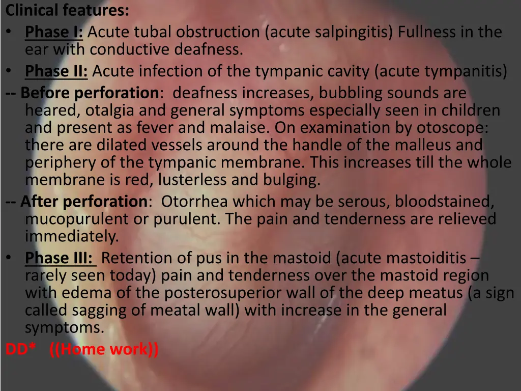 clinical features phase i acute tubal obstruction