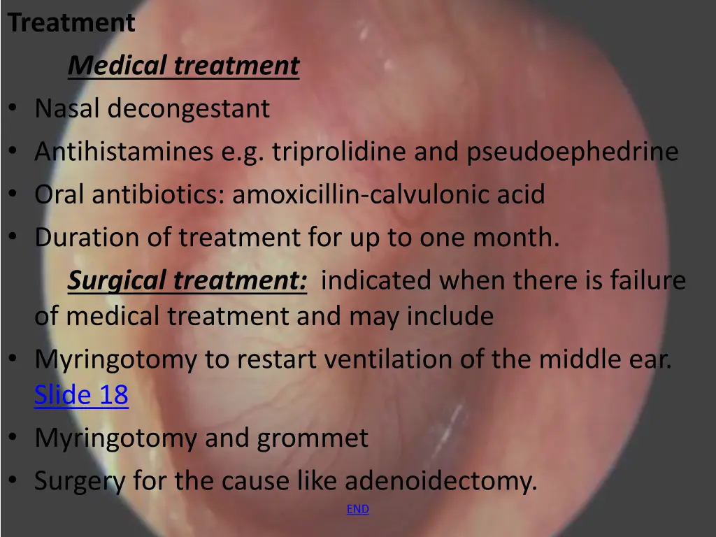 treatment medical treatment nasal decongestant