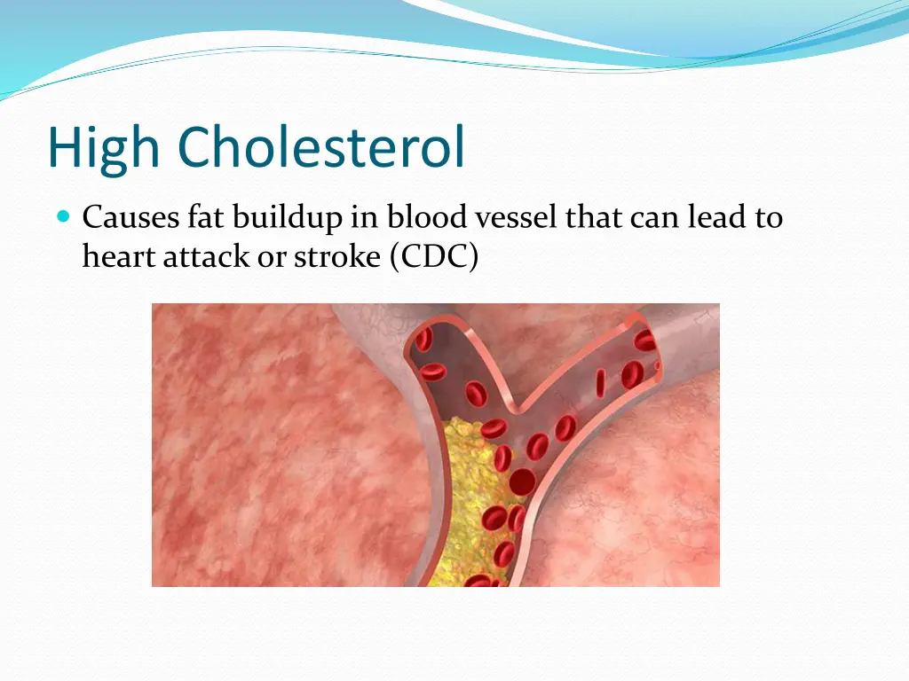 high cholesterol