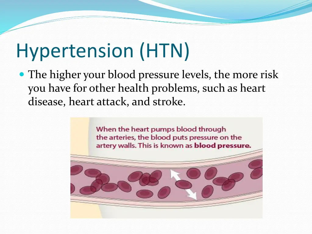 hypertension htn