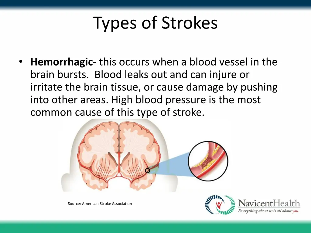 types of strokes 1