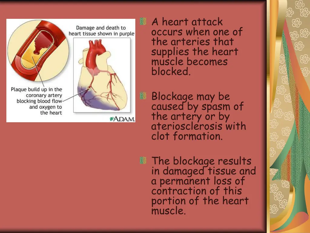 a heart attack occurs when one of the arteries