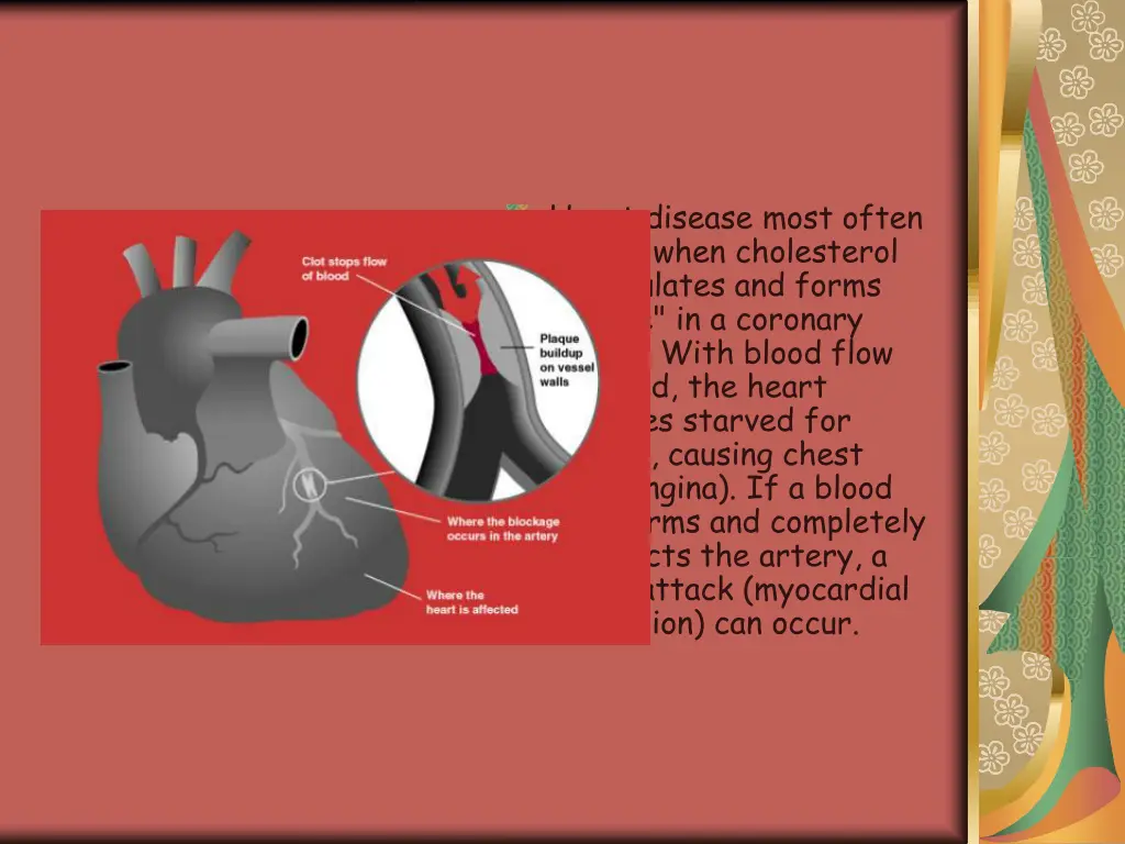 heart disease most often occurs when cholesterol