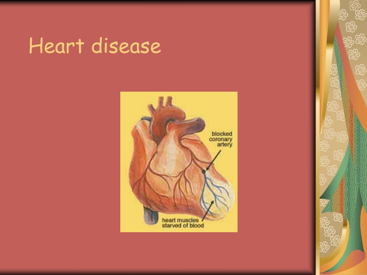 heart disease