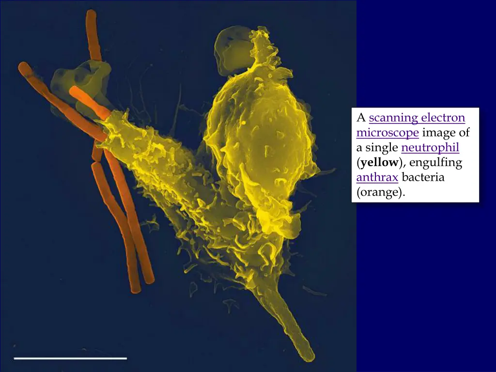 file neutrophil with anthrax copy jpg