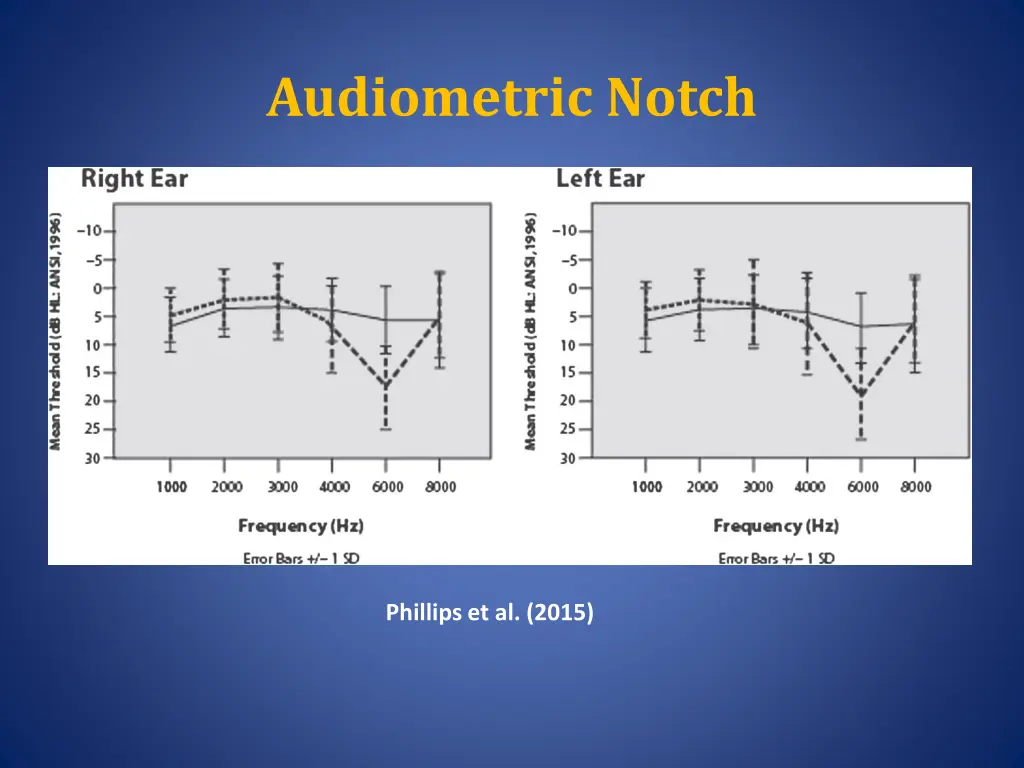 audiometric notch