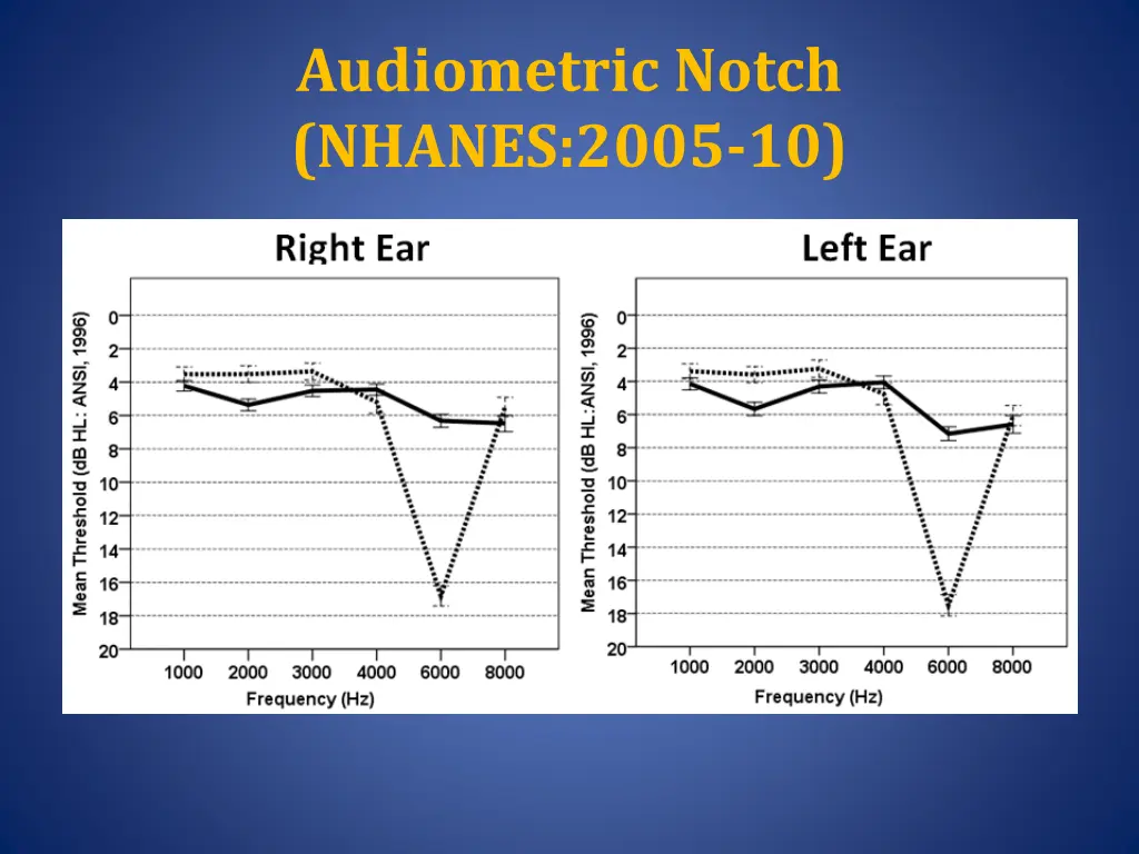 audiometric notch nhanes 2005 10