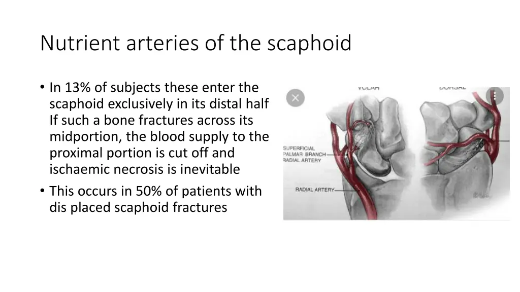 nutrient arteries of the scaphoid