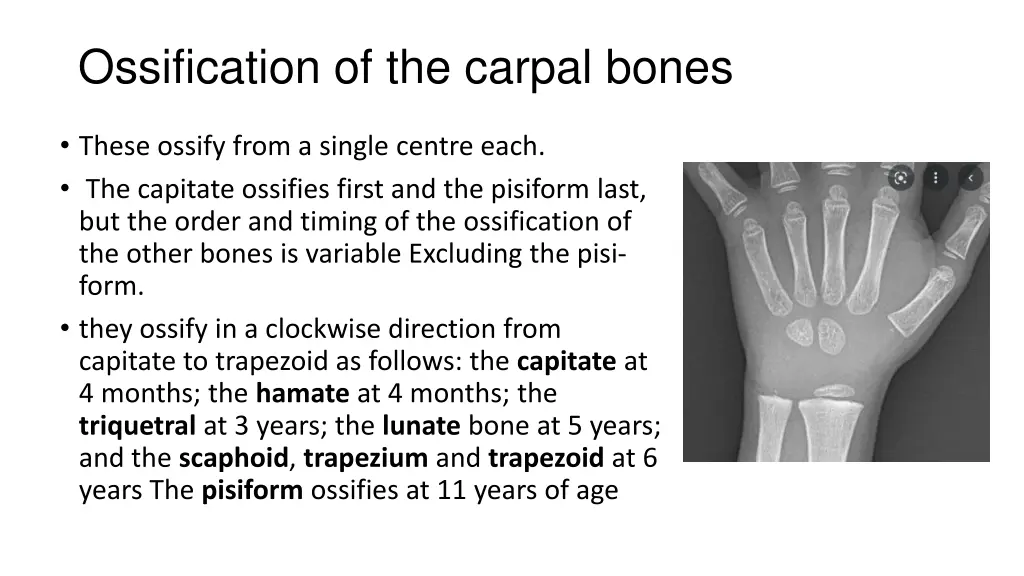 ossification of the carpal bones