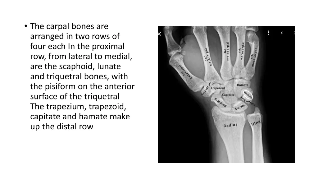 the carpal bones are arranged in two rows of four