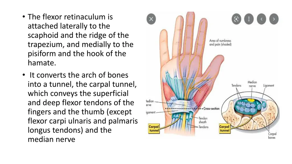 the flexor retinaculum is attached laterally