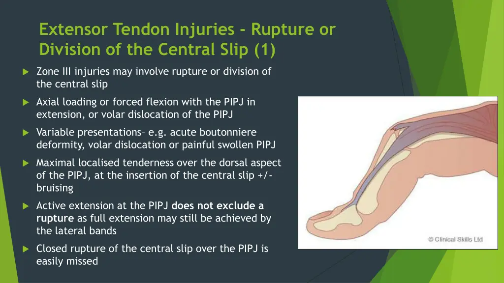 extensor tendon injuries rupture or division 1