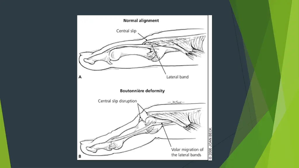 slide21