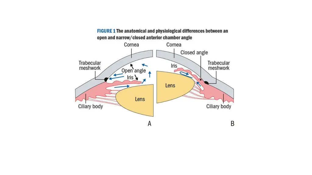 slide10