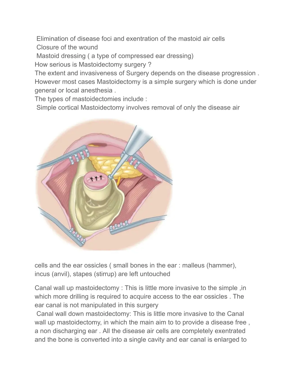 elimination of disease foci and exentration