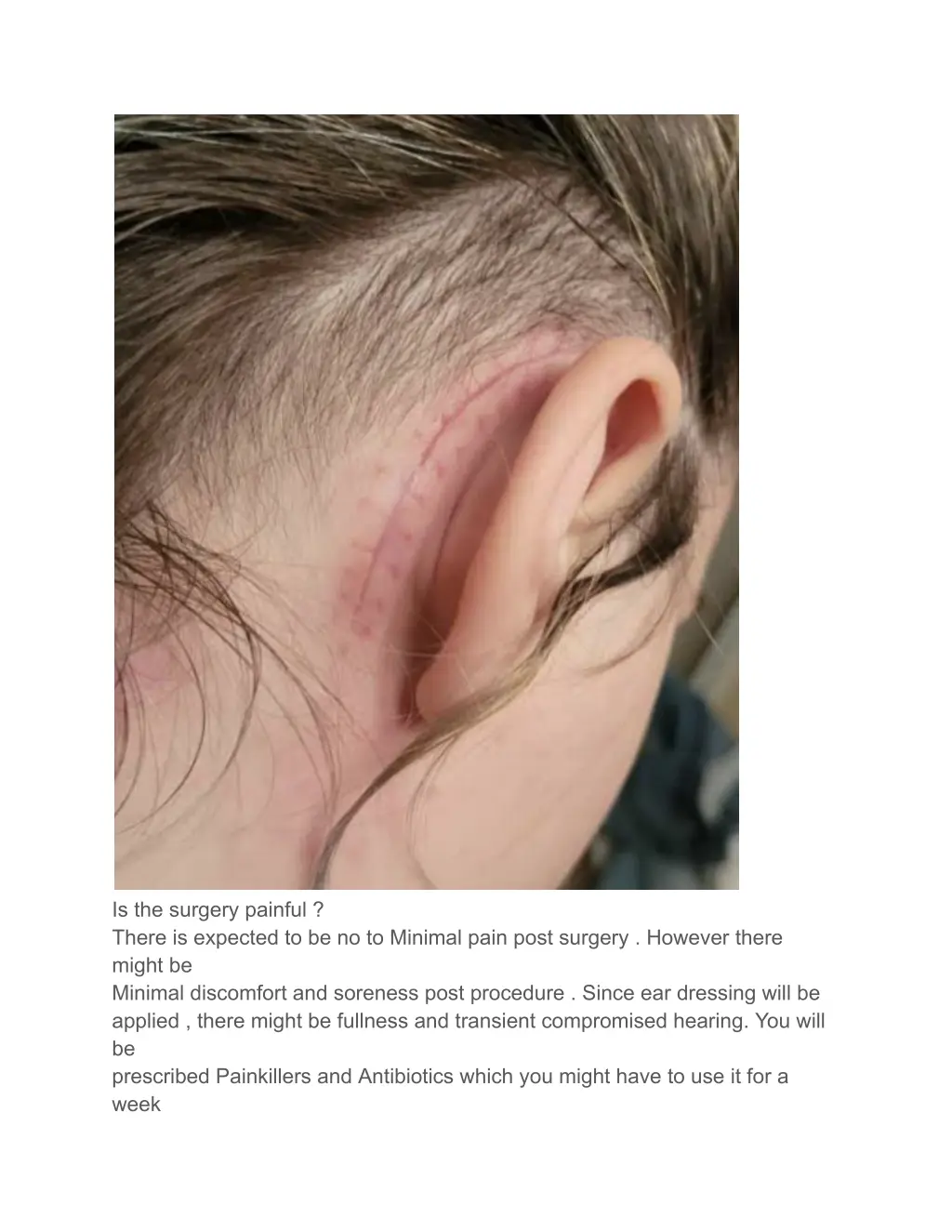 is the surgery painful there is expected