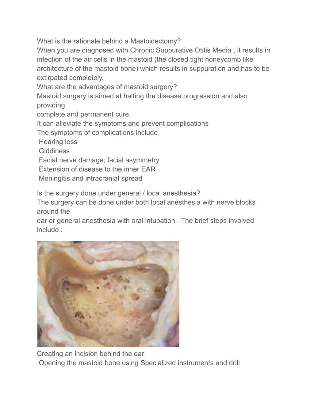 what is the rationale behind a mastoidectomy when