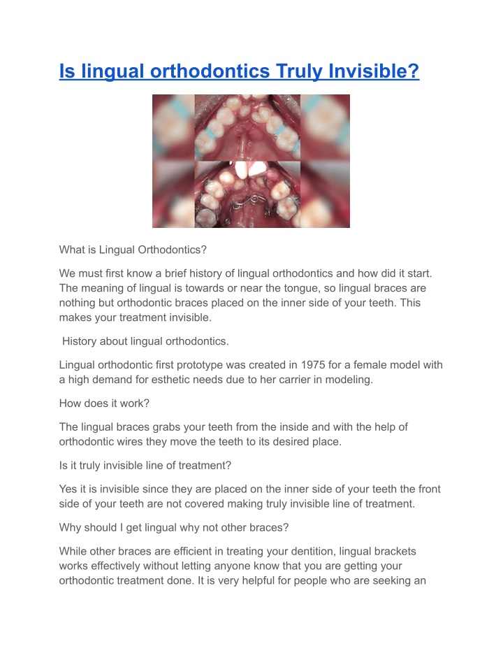 is lingual orthodontics truly invisible