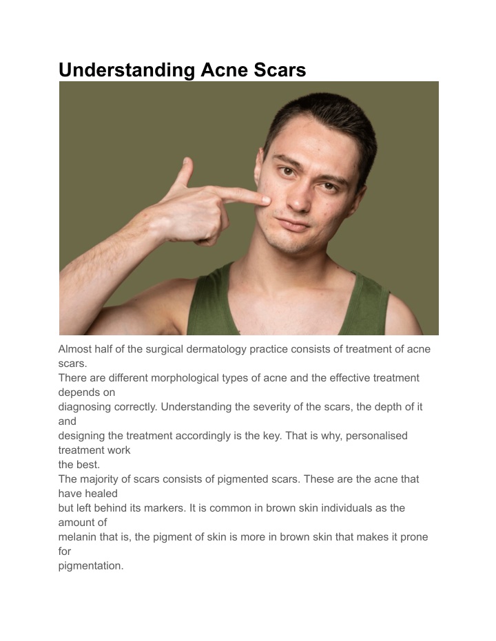 understanding acne scars