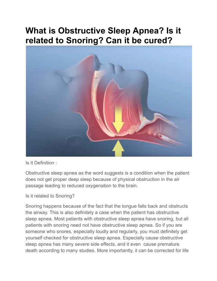 what is obstructive sleep apnea is it related