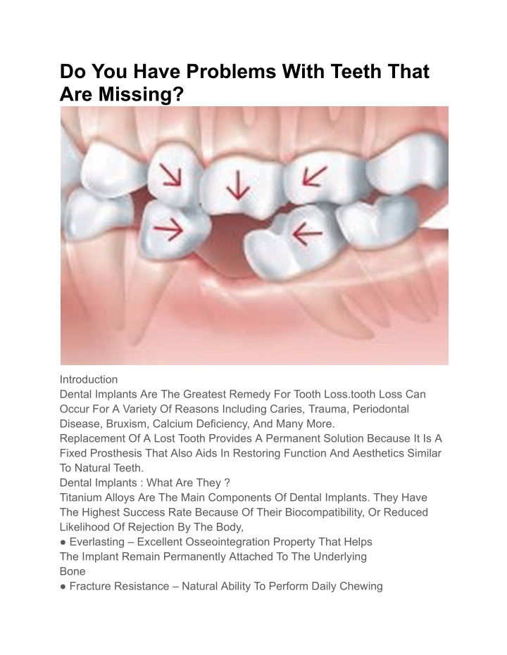 do you have problems with teeth that are missing