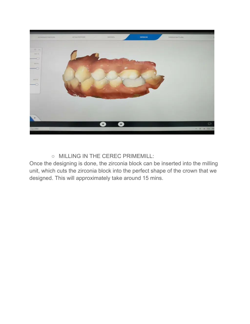 milling in the cerec primemill once the designing