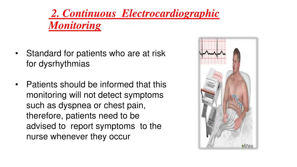 2 continuous electrocardiographic monitoring